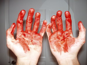 File:Bloody hands.jpg
