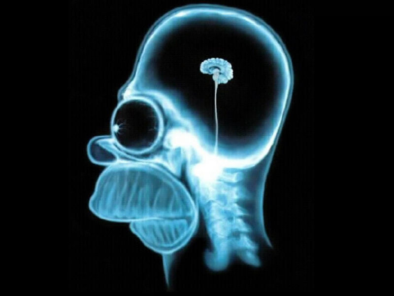 File:Homer-simpson-brain.jpg