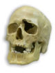 Human skull with gunshot.jpg